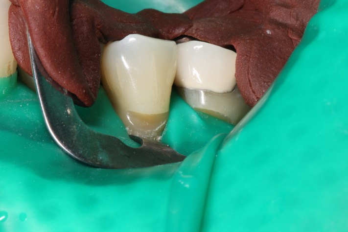 Ted Kanamori #4 pre-op