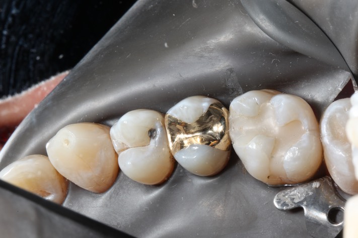 Frank Fukuda #4 finish