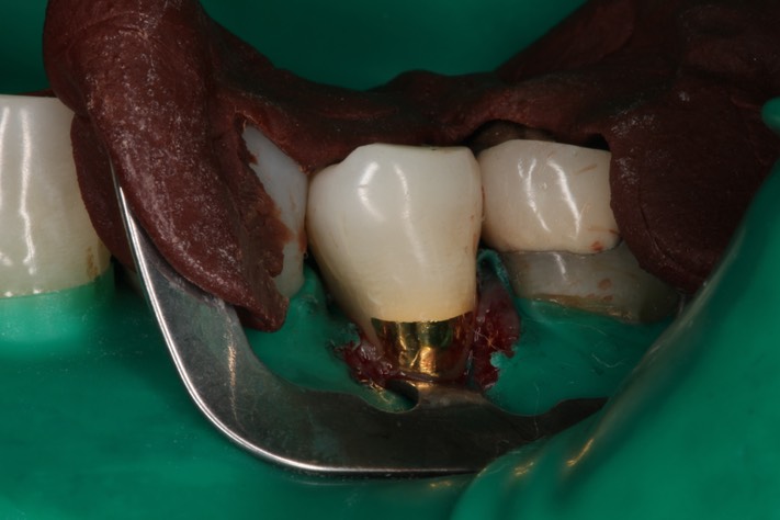 Ted Kanamori #4 finish