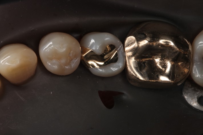 Larry Fujioka #20 finish