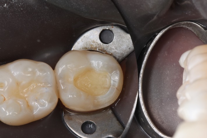 Russ Tabata #13 prep