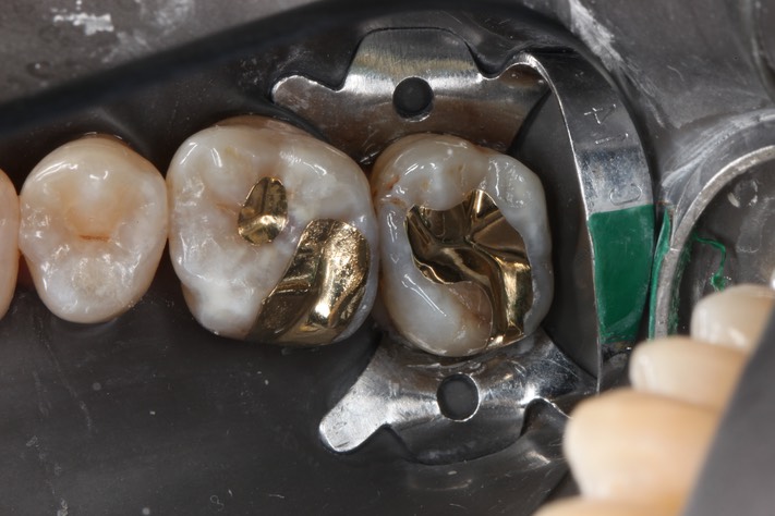 Mendel Sato #2 finish