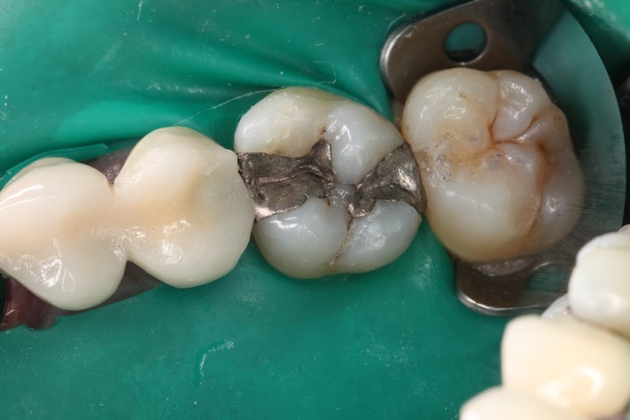 Ted Kanamori #3 pre-op