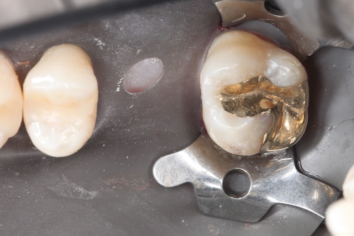 Kyle Chock #2 try in