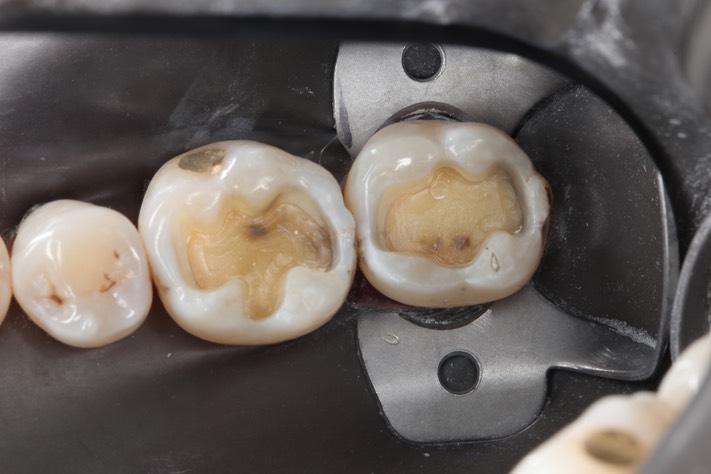 Gary Umeda #18-19 prep