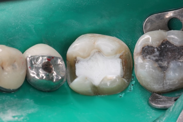 Scott Kanamori #19 prep