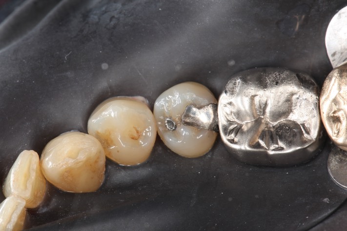 Wayne Chin #20 pre-op