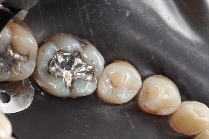 Kyle Chock #30 pre-op