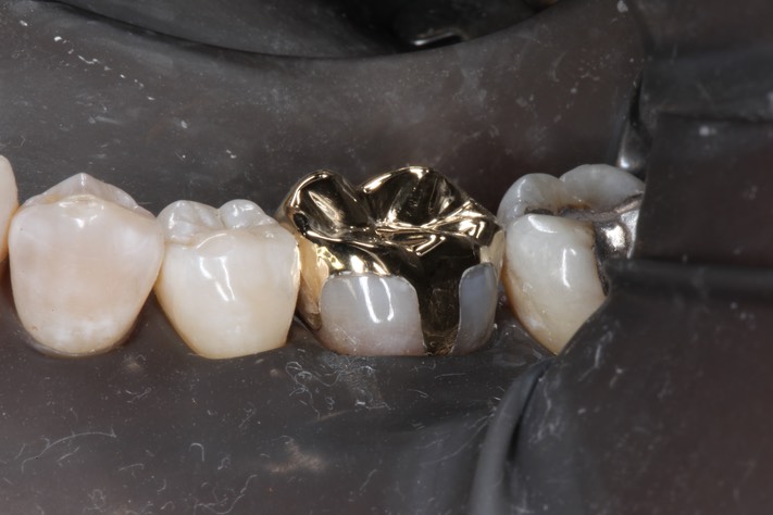 Frank Fukuda #19 cementation