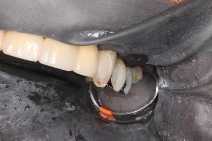 Alan Chinn #12 anterior view