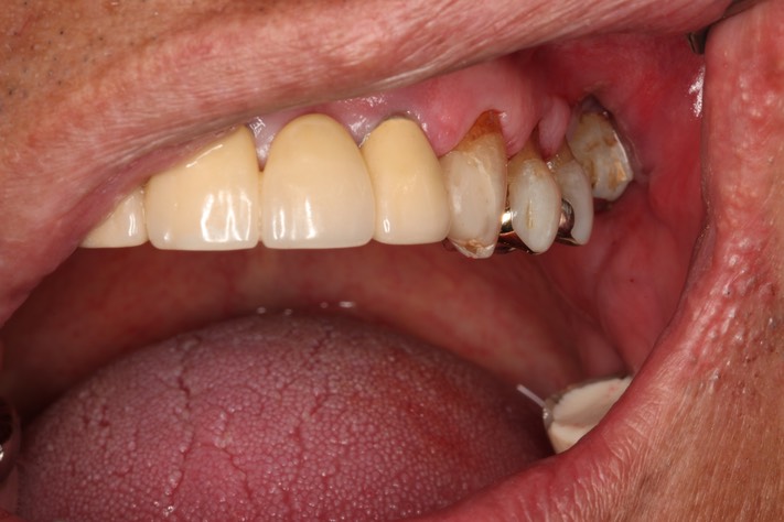 Alan Chinn #12 anterior view