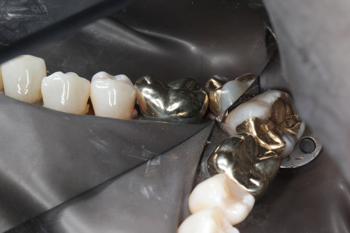 Chris Woo #30 finish 