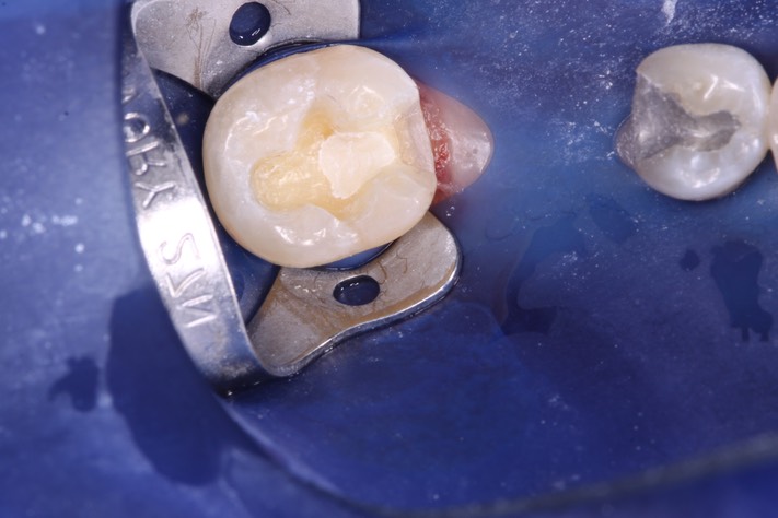 Carl Kobayashi #19 prep