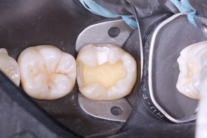 Carla Fukumoto #18 prep