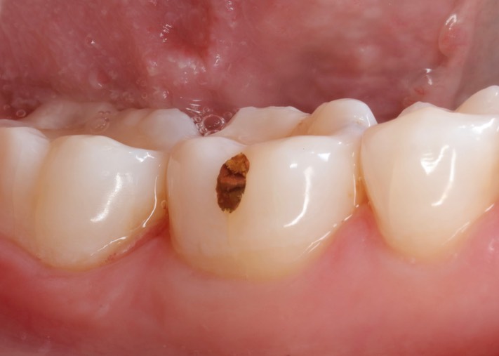 Joe Cha #19 finish 2