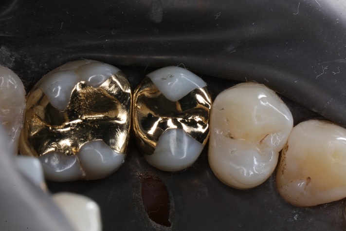 Kyle Chock #13 finish