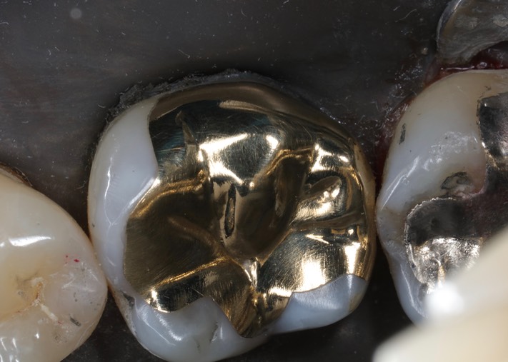 Kyle Chock #19 finish