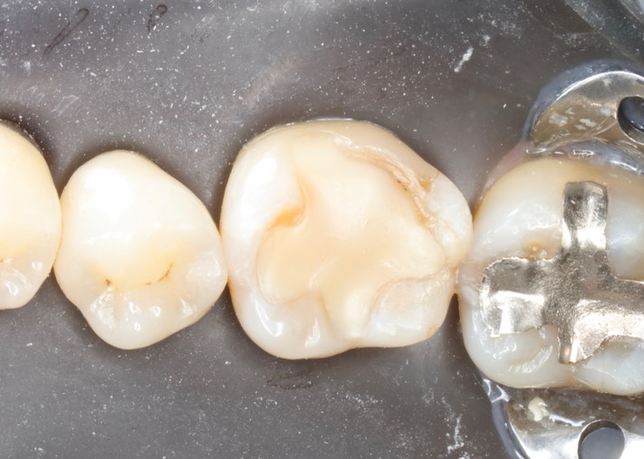 Kyle Chock #19 pre-op