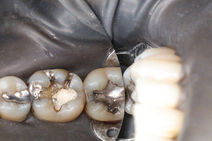 Kyle Chock #19 pre-op