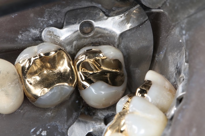 Kyle Chock #2 finish