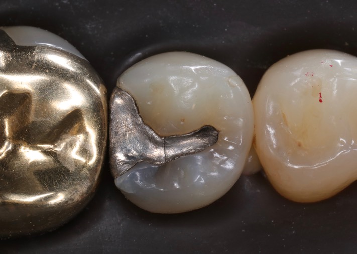 Kyle Chock #29 pre-op