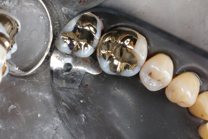 Kyle Chock #30-31 finish