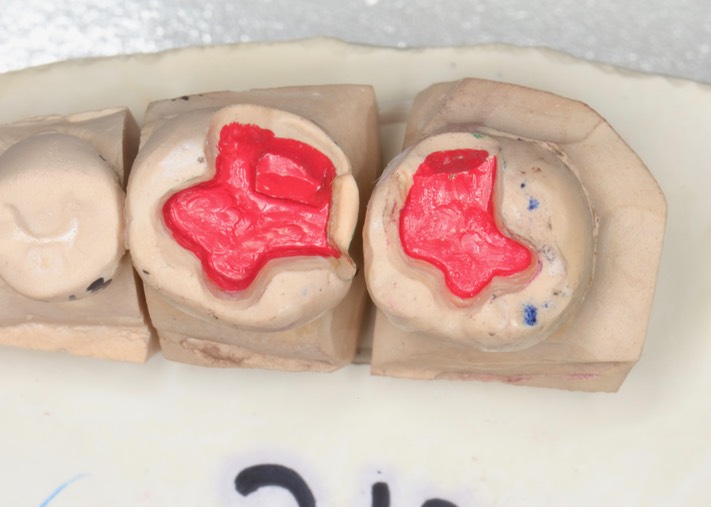 Kyle Chock #30-31 models