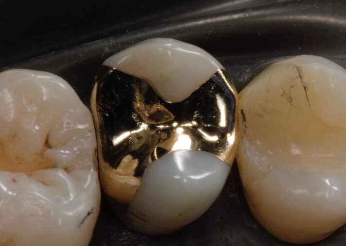 Kyle Chock #4 finish