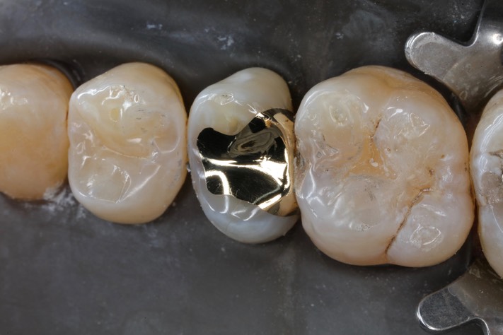 Kyle Chock #4 finish