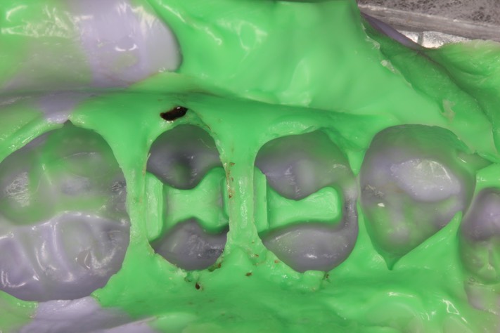 Kyle Chock #12-13 impression