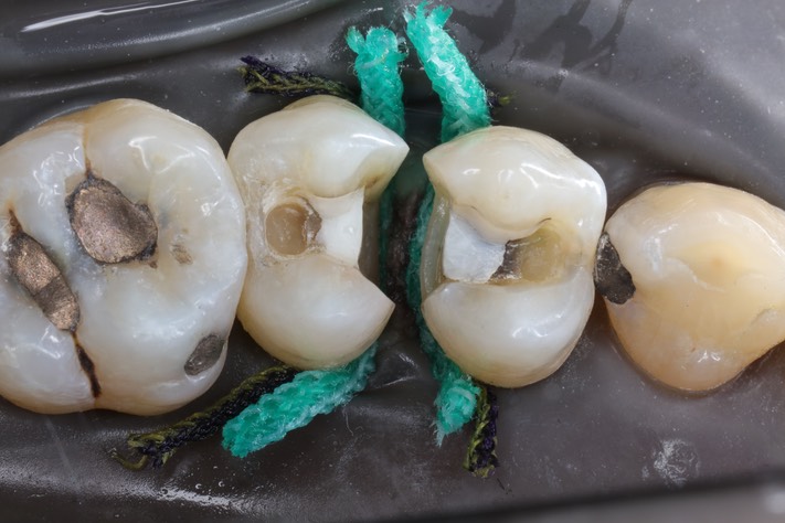 Larry Fujioka #12-13 prep