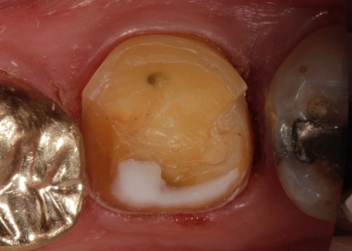 Larry Fujioka #18 prep