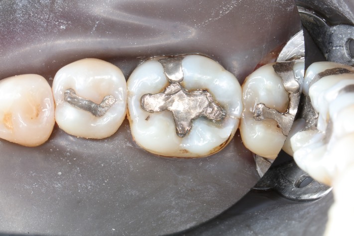 Larry Fujioka #19 pre-op