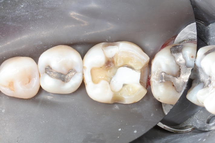 Larry Fujioka #19 prep