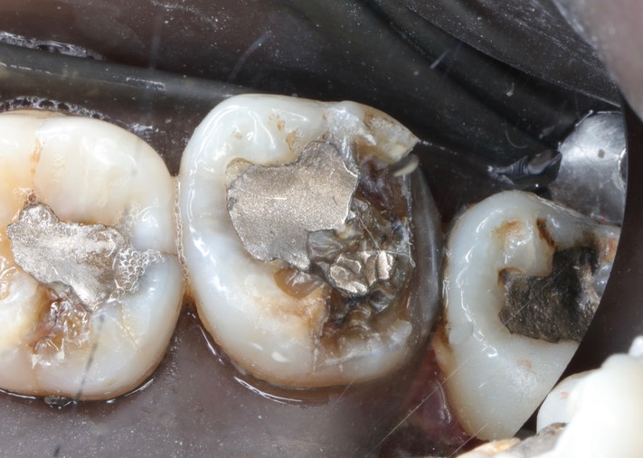 Larry Fujioka #2 pre-op