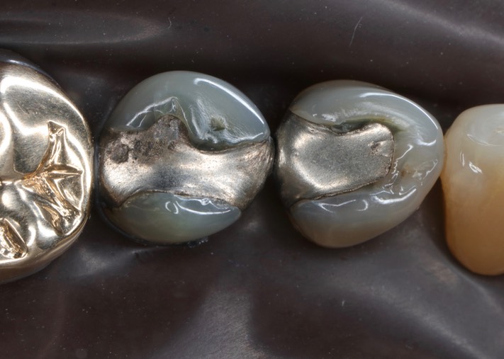 Larry Fujioka #28-29 pre-op