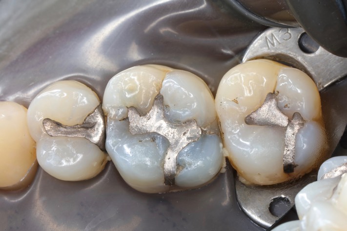 Larry Fujioka #3 pre-op