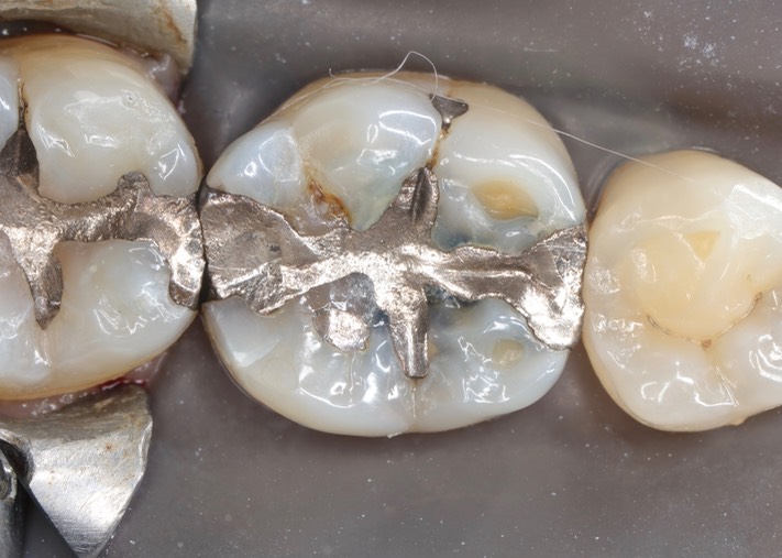 Larry Fujioka #30 pre-op