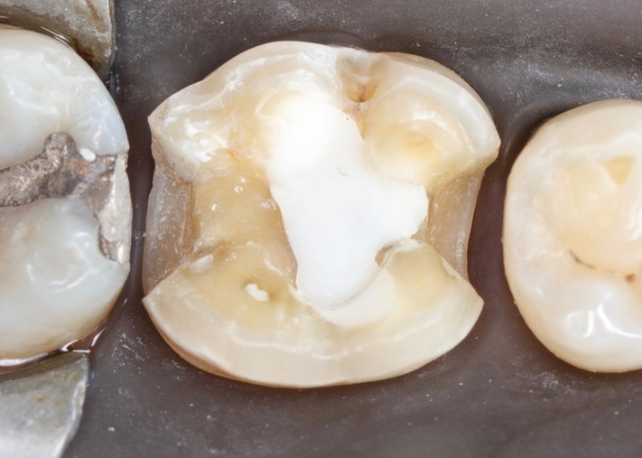 Larry Fujioka #30 prep