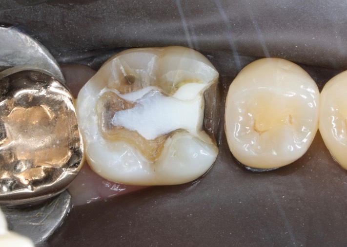 Larry Fujioka #30 prep