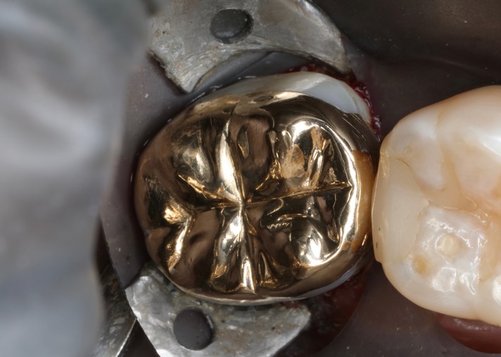 Larry Fujioka #31 finish