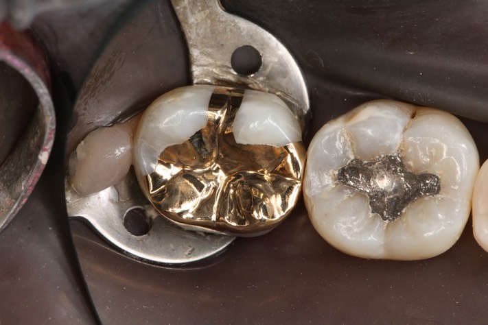 Larry Fujioka #31 finish