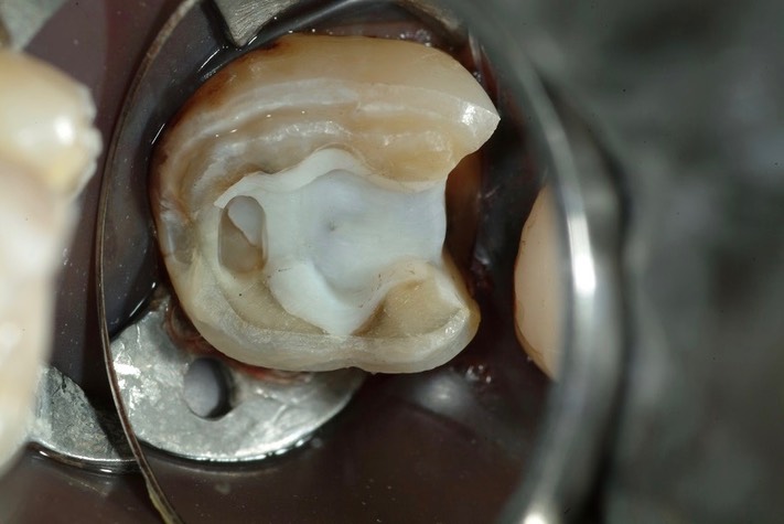 Larry Fujioka #31 prep