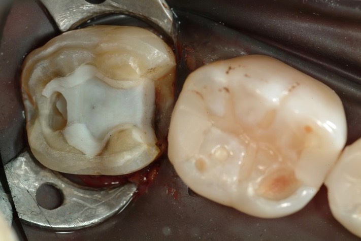 Larry Fujioka #31 prep