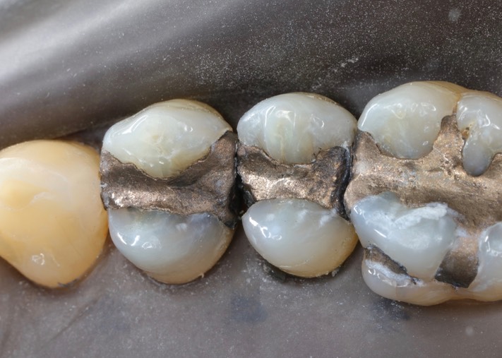 Larry Fujioka #4-5 pre-op