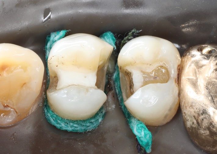 Larry Fujioka #4-5 prep