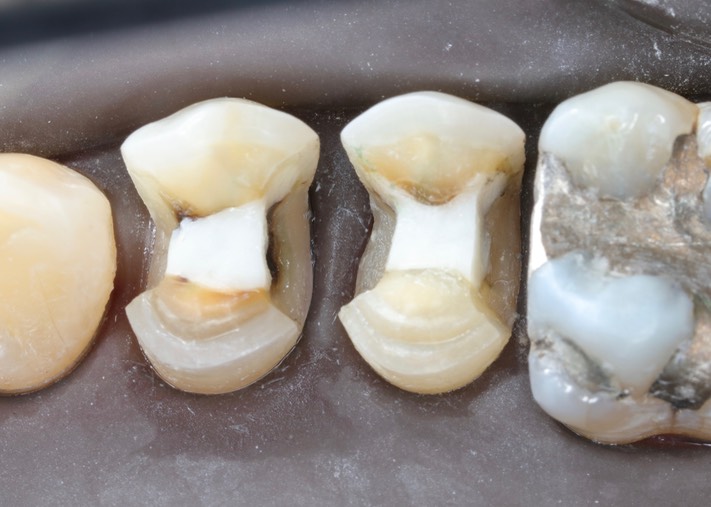 Larry Fujioka #4-5 prep