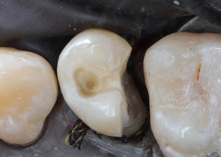 Larry Fujioka #4 prep