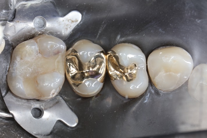 Mark Chun #12-13 finish