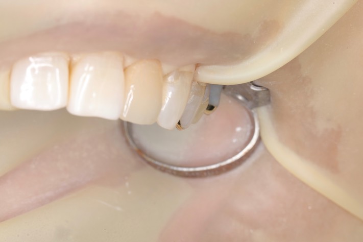 Mark Chun #12 finish